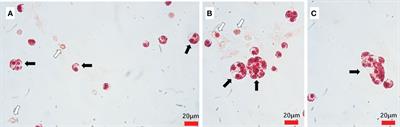 Macrophthalmus (Macrophthalmus) abbreviatus Manning & Holthuis, 1981, a new natural host for Hematodinium perezi infection